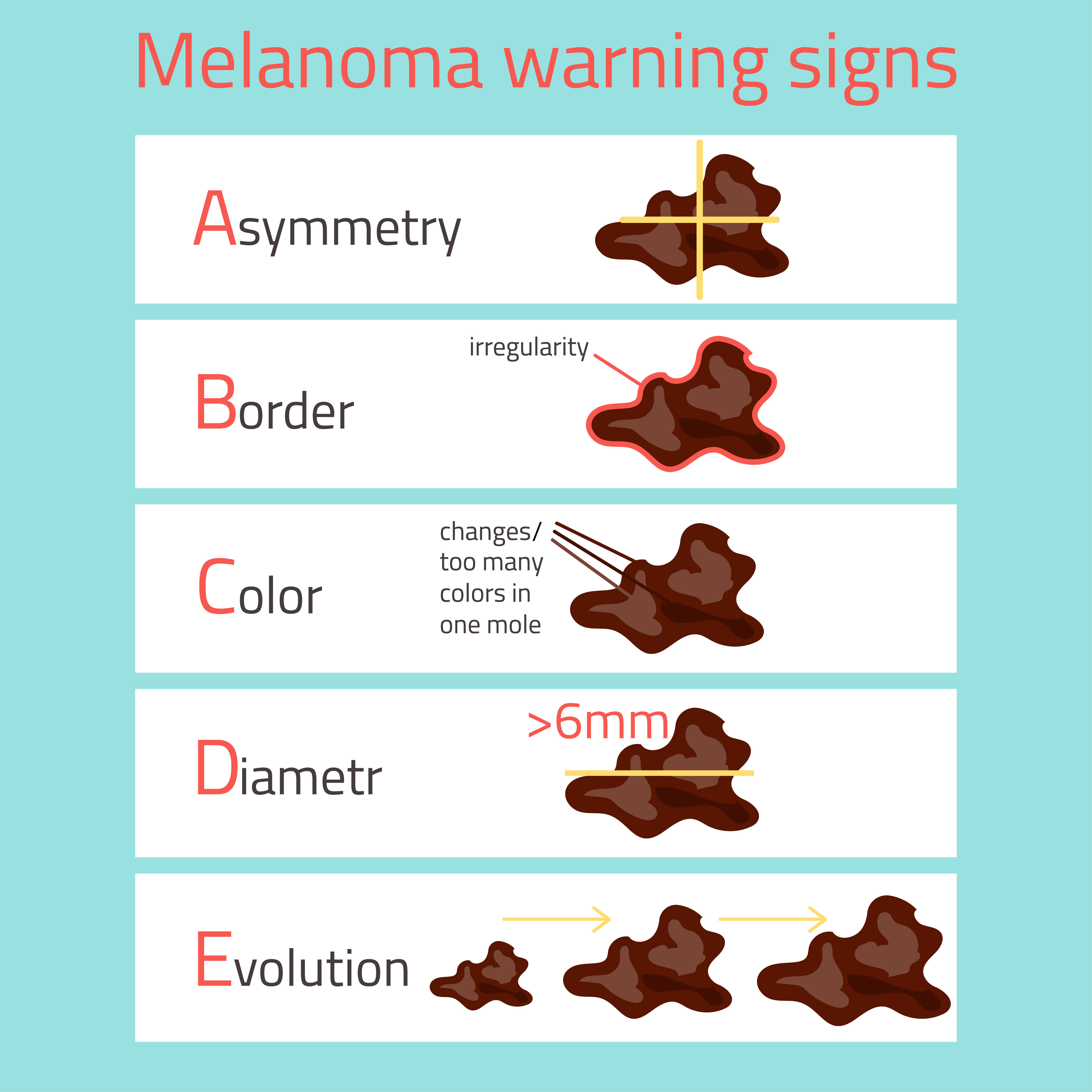 Melanoma Warning Signs